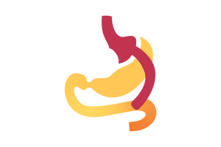 Gastric Bypass (RNY)